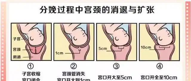 看完心疼妈妈|产妇|分娩|子宫|宫缩_网易订阅