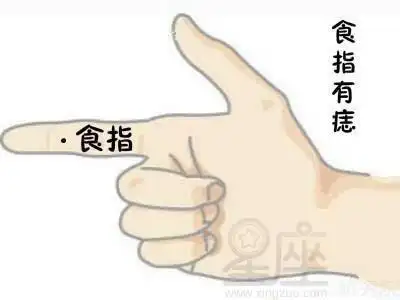 食指内侧长痣代表什么,食指内侧长痣好不好