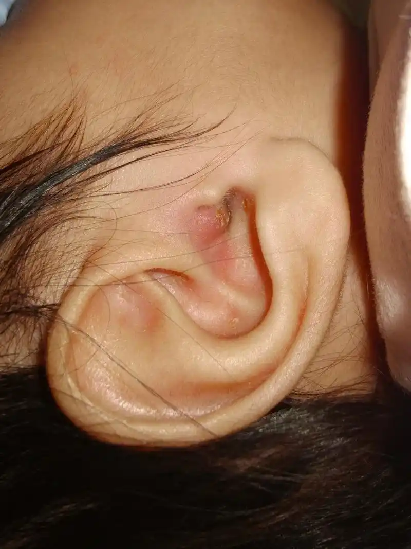 有宝妈知道的吗?