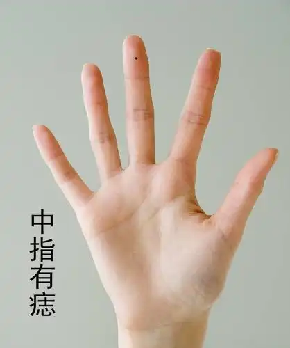 手上长痣是好是坏,都有什么寓意