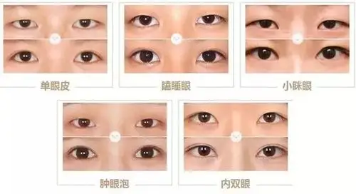 霍思燕竟能给嗯哼搓出双眼皮!但她自己的双眼皮肯定不是这么来的