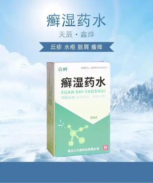鑫烨 癣湿药水 30ml*1瓶/盒 用于风湿虫毒所致的鹅掌风 脚湿气 丘疹