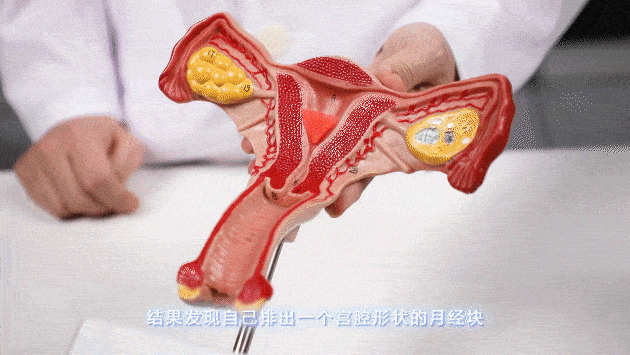 月经颜色越红越好?答案意想不到_来源_图片_子宫