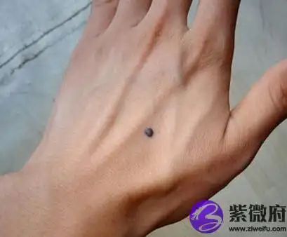 手上痣的位置与命运分析