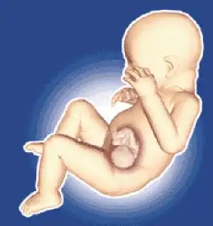 胎中胎模拟图香港消息 医疗科技进步令人可窥视母体内的胎儿,香港玛丽