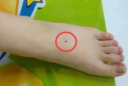 缘大师面相命理:人各有"痣",分析最常见的30种痣,你是哪颗?