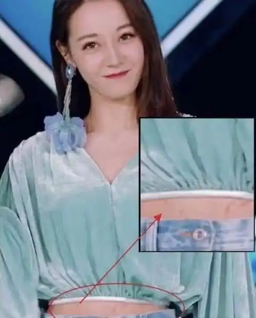 迪丽热巴肚子上有妊娠纹也有说是肥胖纹其实都不对那是伤疤