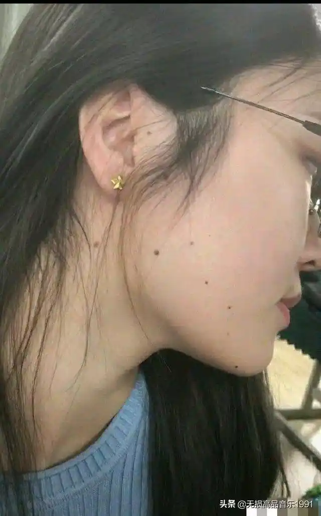 有懂看面相的吗?这痣是北斗七星吗?