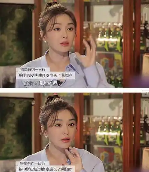 秦岚素颜被"曝光",为拍戏整张脸爆痘200颗!真不容易_延禧_琼瑶_评价