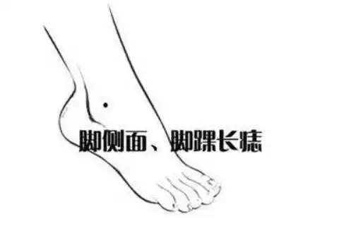 在痣相学中,长在左脚踝的痣叫:"坎坷痣",说明了这个人的天生就是比较
