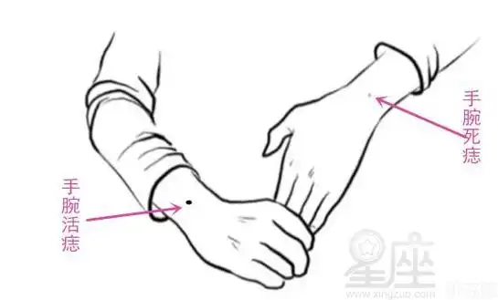 女生右手手腕有痣代表什么,手腕有痣代表什么_运势阁