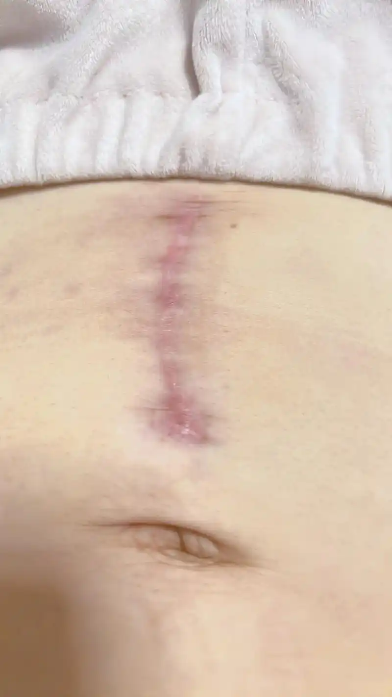 你说凭什么让着我.就凭我难产,就凭我同时受了两种不一样的罪, - 抖音