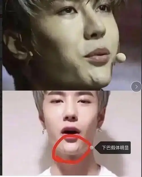 整容前后判若两人却自称是天然脸真当观众看不出吗