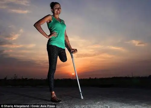 萨博瑞特虽然失去一条腿,却没有放弃跳舞的梦想.