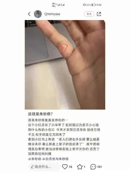 这是朱砂痣长在无名指上面