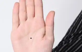 掌心痣的位置与命运解析男女掌心有痣代表什么