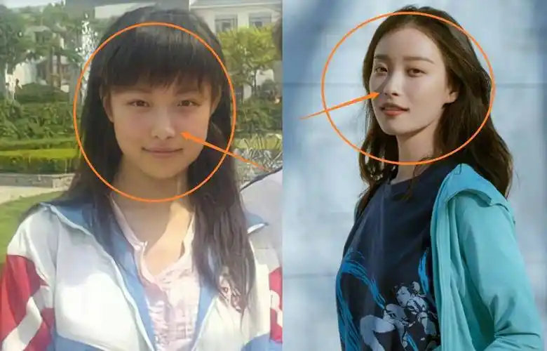 原创都说倪妮颜值不是一般高看到她中学时期的模样有无整容很显然