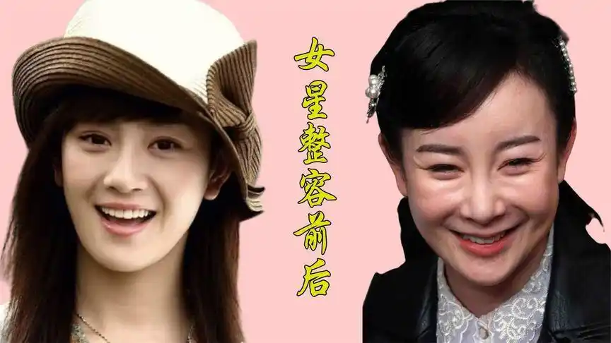 女星整容前后对比,鞠婧祎成四千年美女,张檬整容失败面目全非
