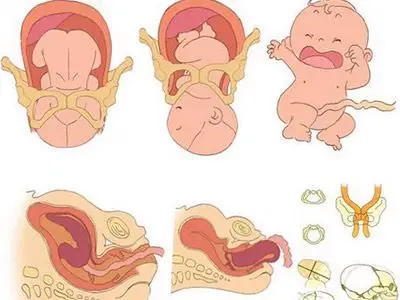 育儿抉择顺产和剖腹产相比哪个更好