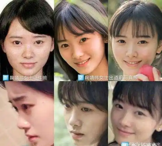 女星整容前后对比,有人美貌出众,有人惨不忍睹_柳岩
