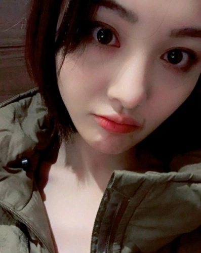 郑爽晒自拍少女感十足 嘴角伤痕惹粉丝心疼