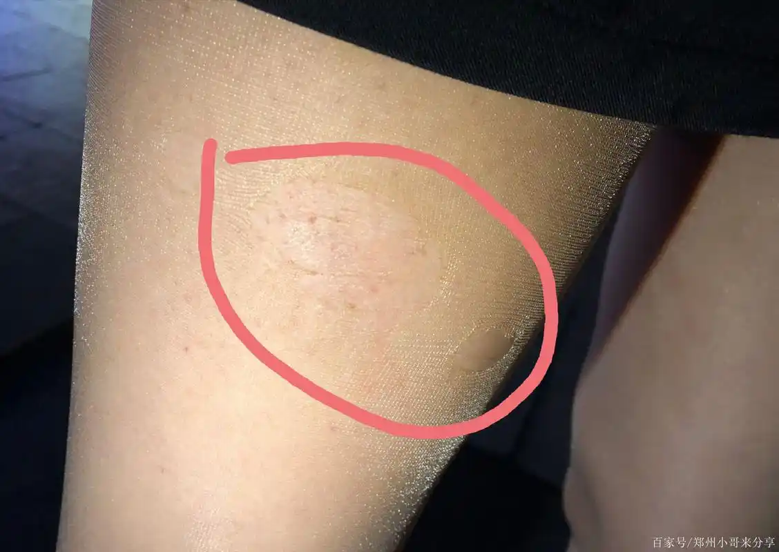 郑州二七广场遇见一个变态,往丝袜上喷不明液体