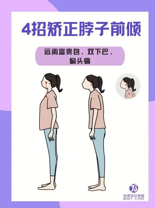 4招矫正脖子前倾远离富贵包双下巴偏头痛