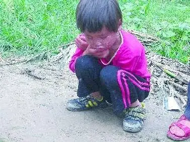 七岁女孩"怪病"缠身六年半