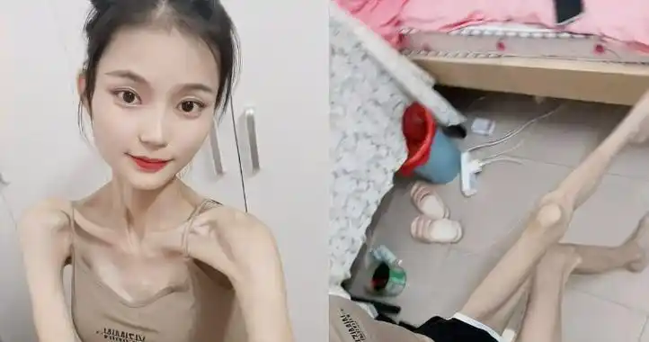 1米6女生体重仅仅31公斤,浑身皮包骨大方秀身材:只为取悦自己