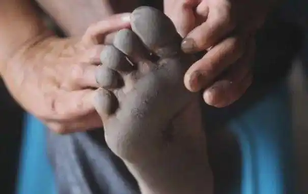 82岁老爷爷光脚20年人称赤脚大仙