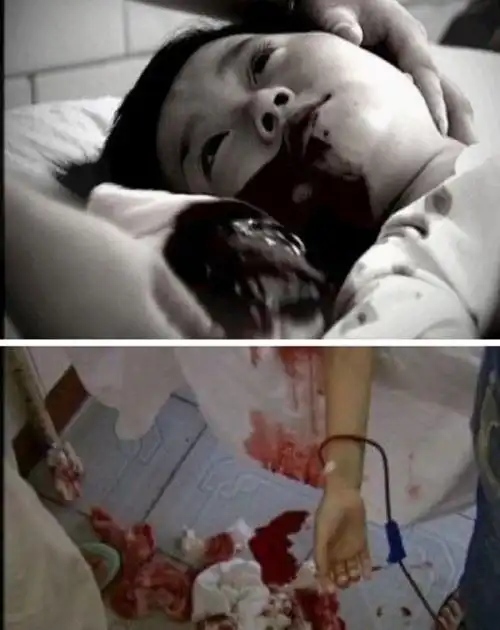 月10日下午,青海省西宁市兴海路兴西居委90号的3岁幼女苏丽因偷吃鸡食