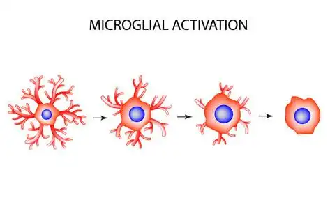 淀粉细胞活化的小胶质细胞.神经元.神经细胞.信息图表.
