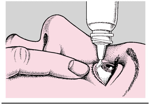 默克家庭诊疗手册:第220节 眼睑和泪腺病