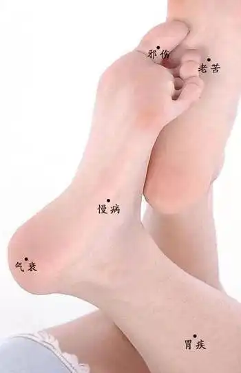 长什么痣,有什么命!非常准!