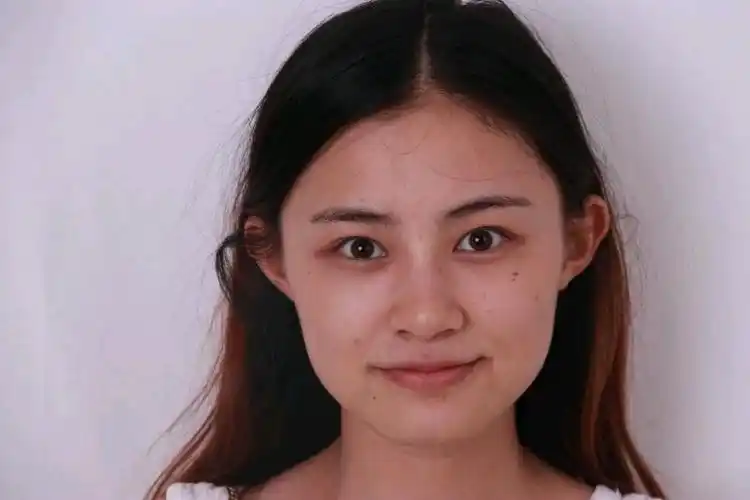 一直觉得自己面部比较扁平脸有点大鼻子也是真的圆钝点都不好看虽然