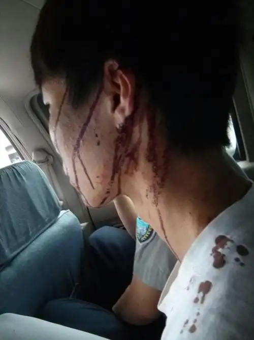 我儿子才十七岁无缘无故被人打,对方先用巴掌打脸,用