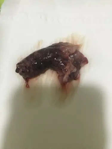 不知道,,,  妹妹,你宠我    2016-07-05 03:47 去医院看看,像是流产