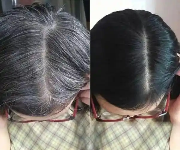 用了黑灵芝洗发水不到半个月,黑发就从根部冒了出来.