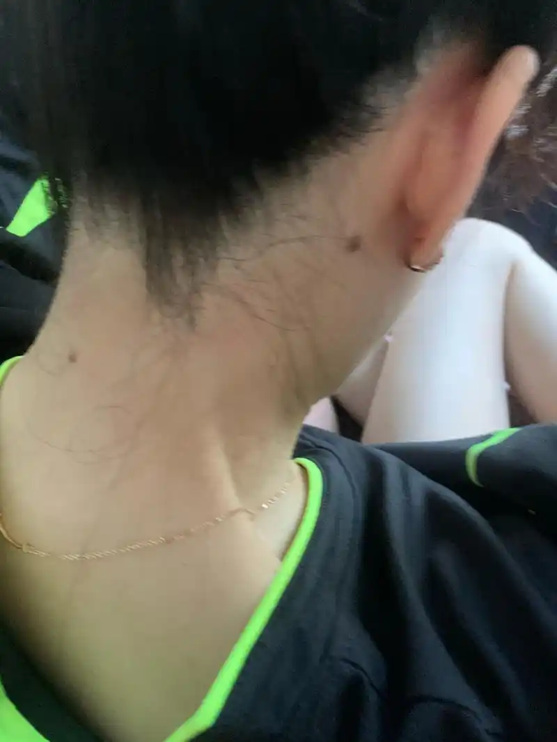 令我最为感动的是好友说这两颗痣一点都不多余,是我的个人特色,是区别