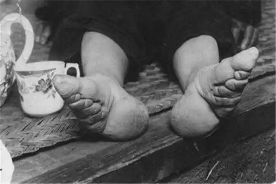 女人裹脚什么时候废除的?中华民国成立后彻底废除