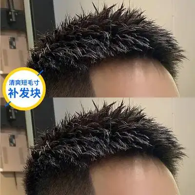 短发真人发丝短款毛寸隐形自然帅气男士发型前额头顶补发其它假发
