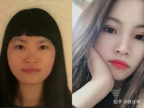 徒手按摩高鼻梁60贫民窟女孩和塌鼻梁say拜拜6060