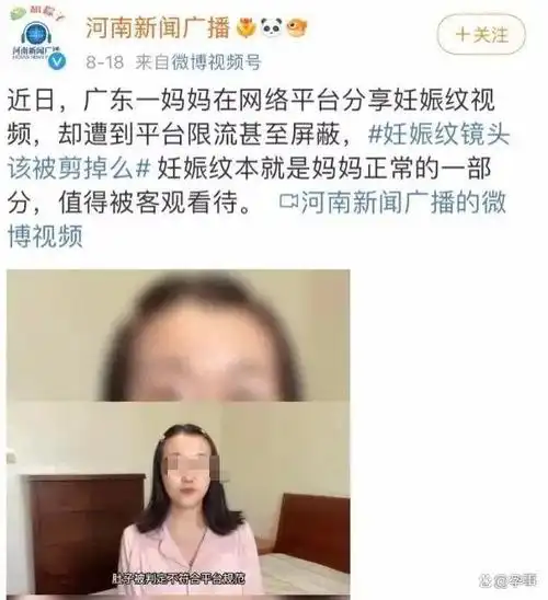 宝妈晒产后满是妊娠纹的肚子网友好吓人大多数都不是这样的