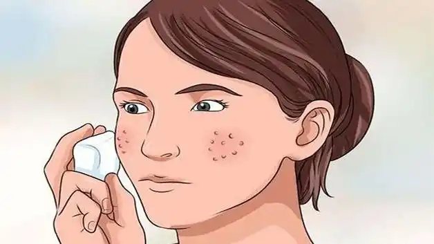 脸颊毛孔粗大什么原因