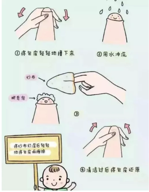 包皮割不割随你,但撸不能停!