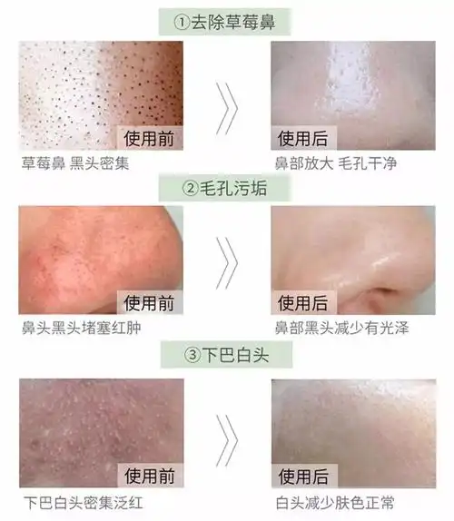 别让污垢塞满你的脸!