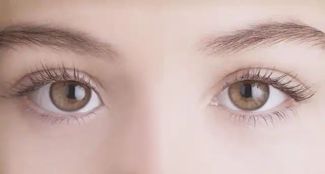 但双眼皮类型有很多,挑选双眼皮类型和手术方式很讲究,如果你的双眼皮