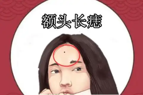 女人额头上方有痣好吗是有什么意思
