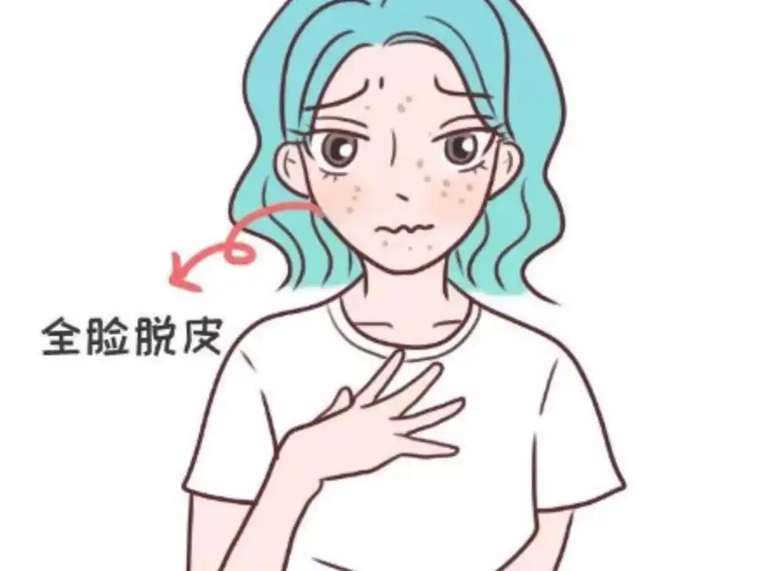 冬季皮肤干燥起皮怎么办