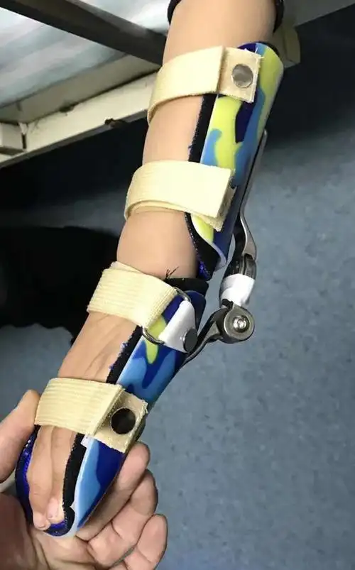 可调腕掌矫形器